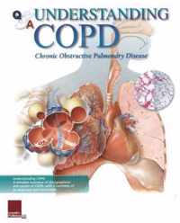 Understanding COPD Flip Chart