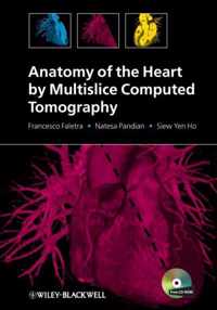 Anatomy of the Heart by Multislice Computed Tomography