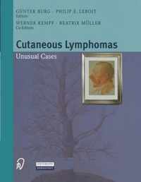 Cutaneous Lymphomas