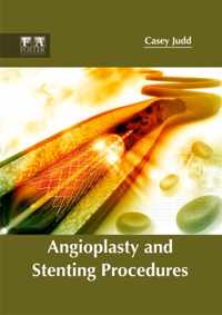 Angioplasty and Stenting Procedures