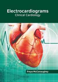 Electrocardiograms