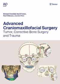 Advanced Craniomaxillofacial Surgery