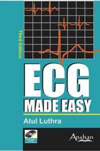 ECG Made Easy