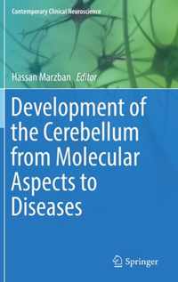 Development of the Cerebellum from Molecular Aspects to Diseases