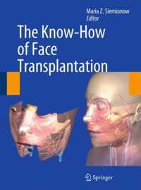 The Know-How of Face Transplantation