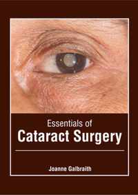 Essentials of Cataract Surgery