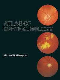 Atlas of Ophthalmology