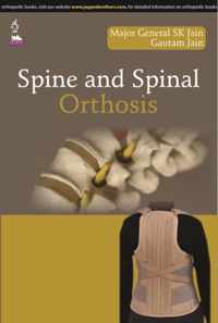 Spine and Spinal Orthosis