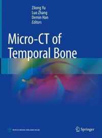 Micro CT of Temporal Bone