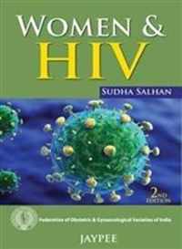 Women and HIV