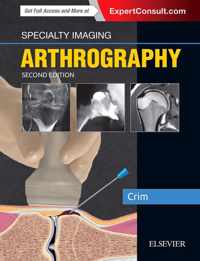 Specialty Imaging: Arthrography