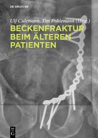 Beckenfraktur beim alteren Patienten