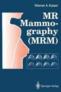 MR Mammography (MRM)