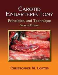 Carotid Endarterectomy