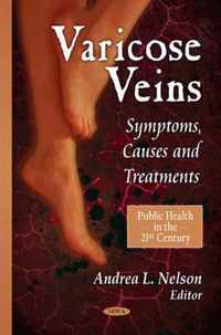 Varicose Veins