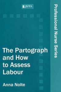 The partograph and how to assess labour