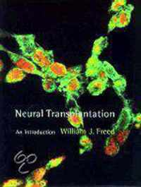 Neural Transplantation