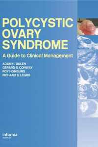 Polycystic Ovary Syndrome