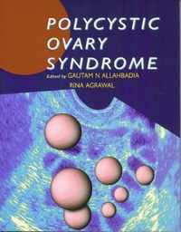 Polycystic Ovary Syndrome