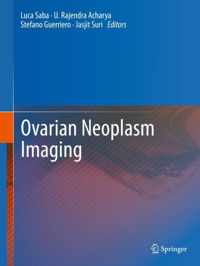 Ovarian Neoplasm Imaging