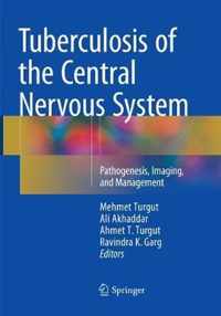 Tuberculosis of the Central Nervous System