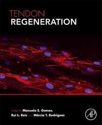 Tendon Regeneration