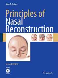 Principles of Nasal Reconstruction