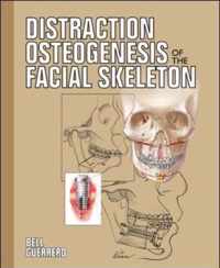 Distraction Osteogenesis of the Facial Skeleton