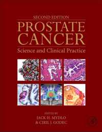 Prostate Cancer