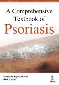 A Comprehensive Textbook of Psoriasis