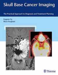 Skull Base Cancer Imaging