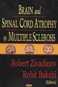 Brain & Spinal Cord Atrophy in Multiple Sclerosis