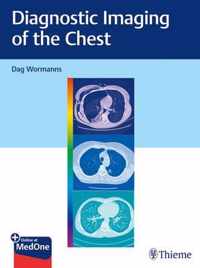 Diagnostic Imaging of the Chest