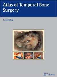 Atlas of Temporal Bone Surgery