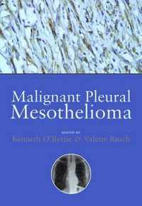 Malignant Pleural Mesothelioma