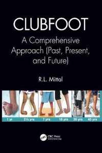 Clubfoot