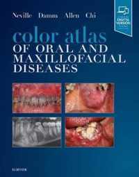 Color Atlas of Oral and Maxillofacial Diseases