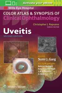 Uveitis