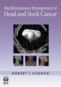 Multidisciplinary Management of Head and Neck Cancer