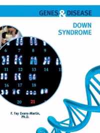 Down Syndrome