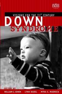 Down Syndrome