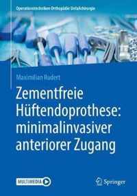 Zementfreie Huftendoprothese