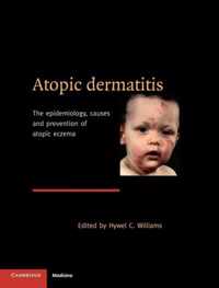 Atopic Dermatitis