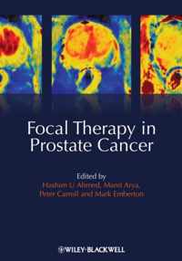 Focal Therapy in Prostate Cancer