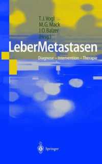 Lebermetastasen