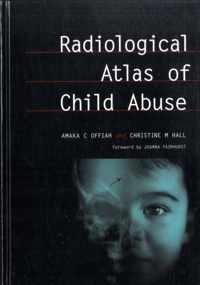 Radiological Atlas of Child Abuse