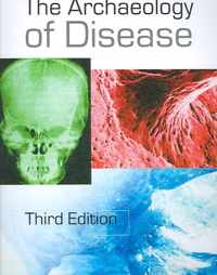 The Archaeology of Disease