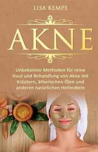 Akne