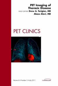 PET Imaging of Thoracic Disease,  An Issue of PET Clinics