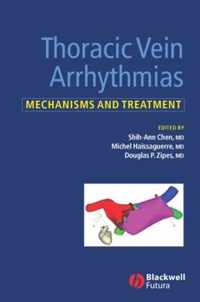 Thoracic Vein Arrhythmias